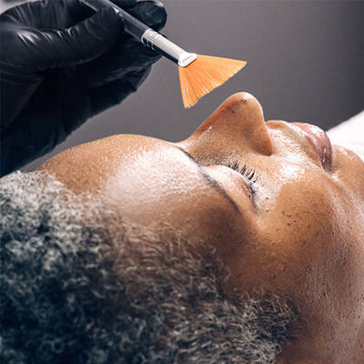 IPL Laser