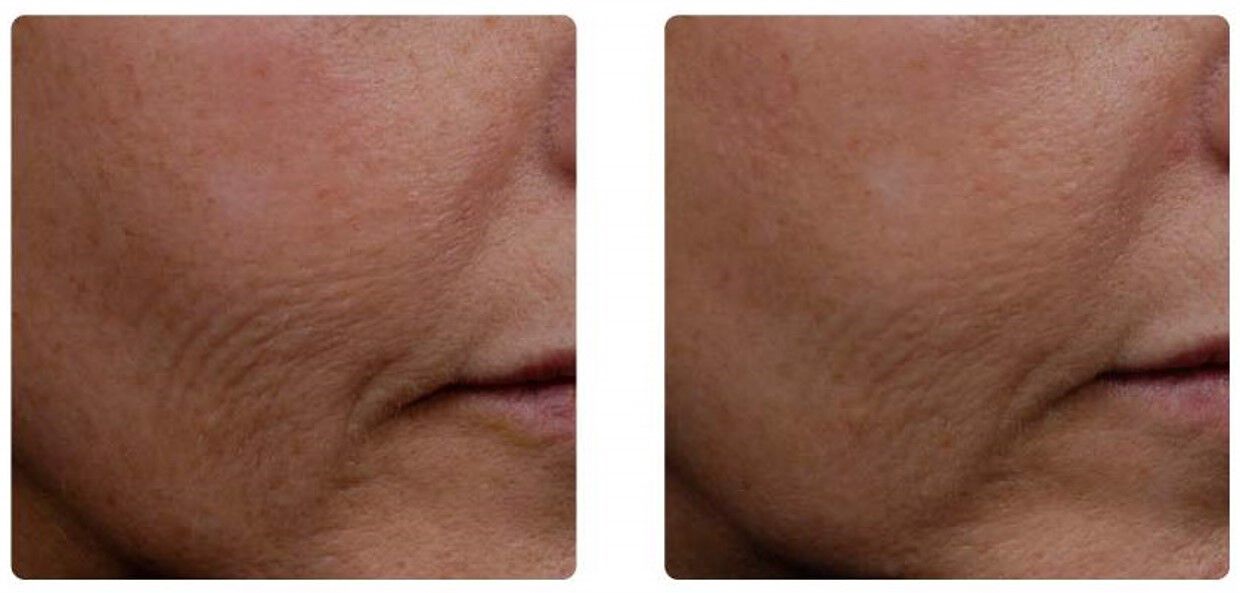 C E Ferulic - Mejora Clinica