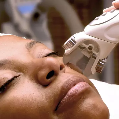 Ultherapy