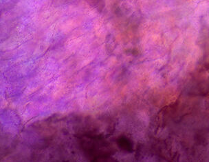 Extracto de Orquidea