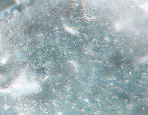 5% Oxido de Zinc (Z-Cote®)