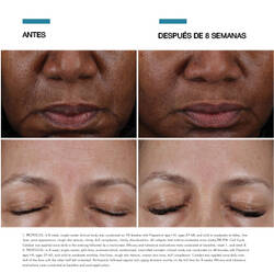 Cell Cycle Catalyst - Estudio Clinico | SkinCeuticals MX