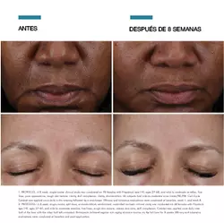 Cell Cycle Catalyst - Estudio Clinico | SkinCeuticals MX