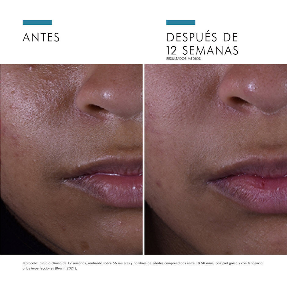 Antes vs Despues de Silymarin CF | SkinCeuticals Mexico