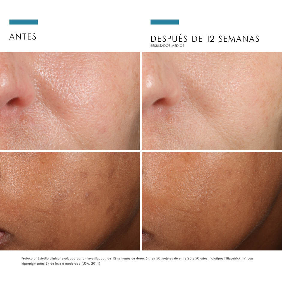 Antes vs Despues de Phloretin CF | SkinCeuticals Mexico
