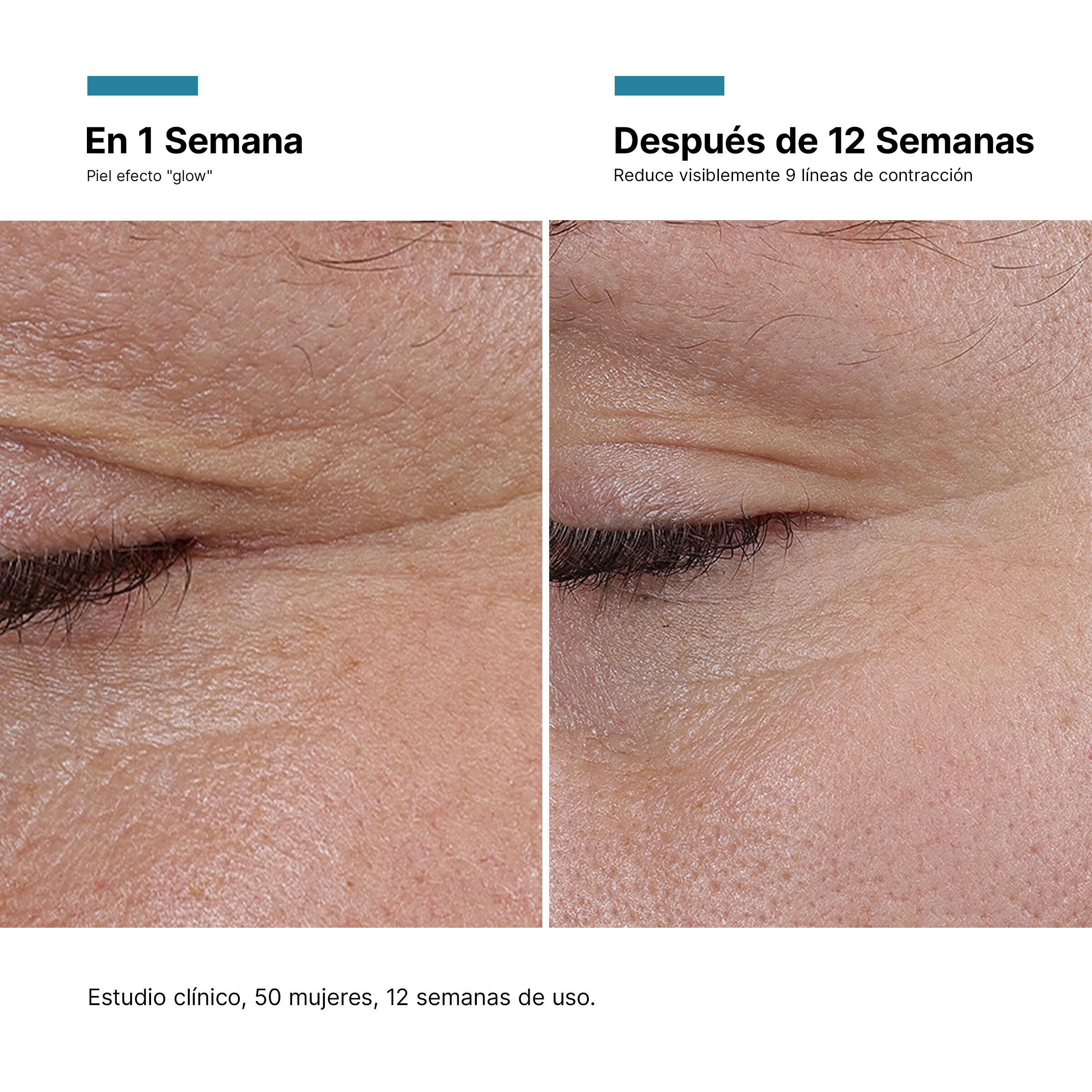 Antes y Despues de P-Tiox | SkinCeuticals Mexico
