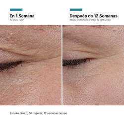 Antes y Despues de P-Tiox | SkinCeuticals Mexico