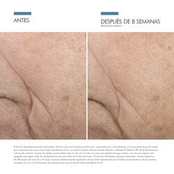 Antes vs Despues de Triple Lipid Restore 2:4:2 | SkinCeuticals Mexico