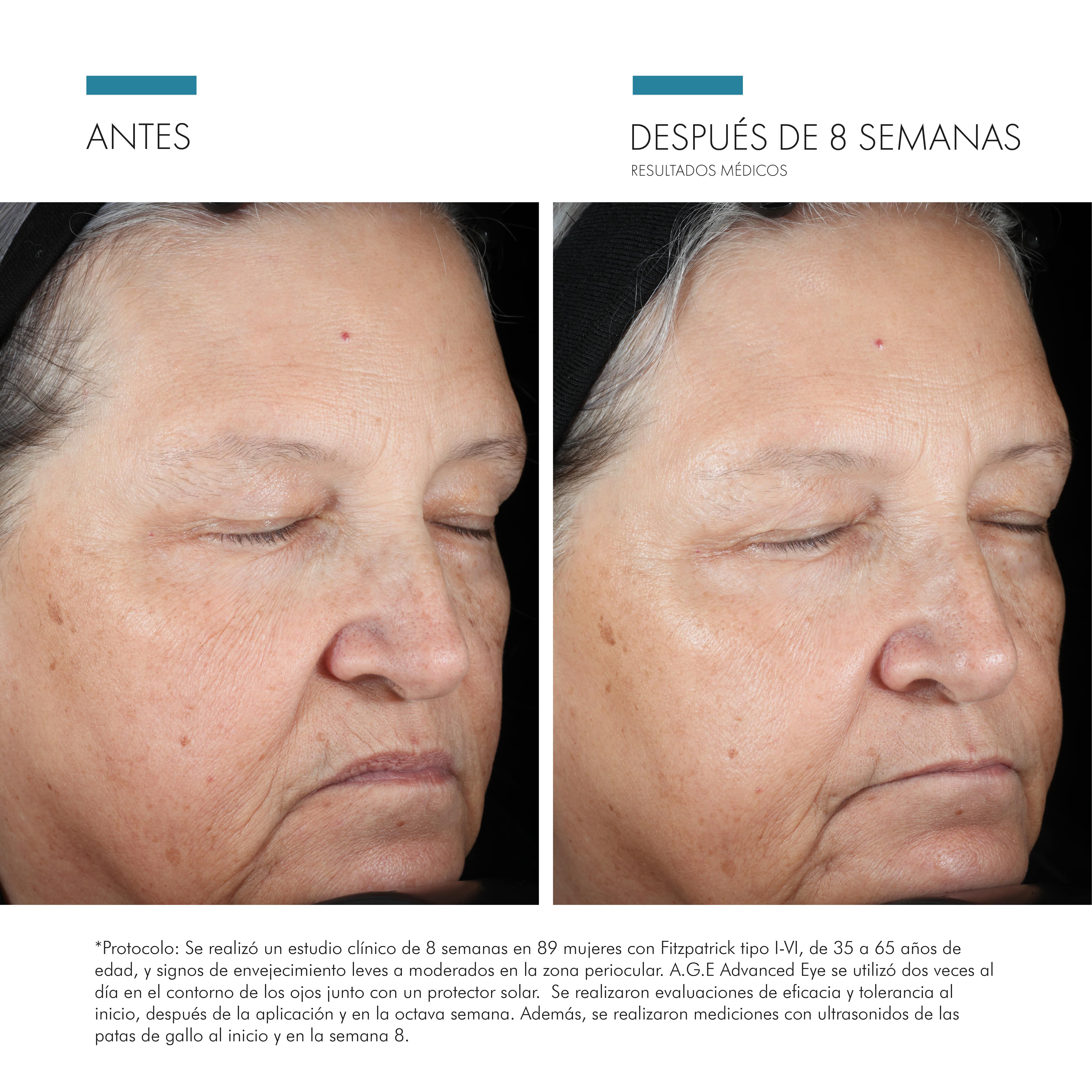 Estudios Clinicos de A.G.E Advanced Eye | SkinCeuticals Mexico