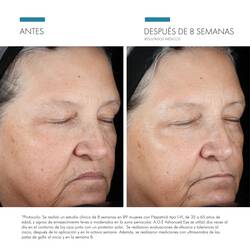 Estudios Clinicos de A.G.E Advanced Eye | SkinCeuticals Mexico