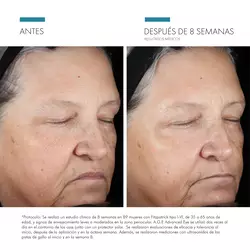 Estudios Clinicos de A.G.E Advanced Eye | SkinCeuticals Mexico