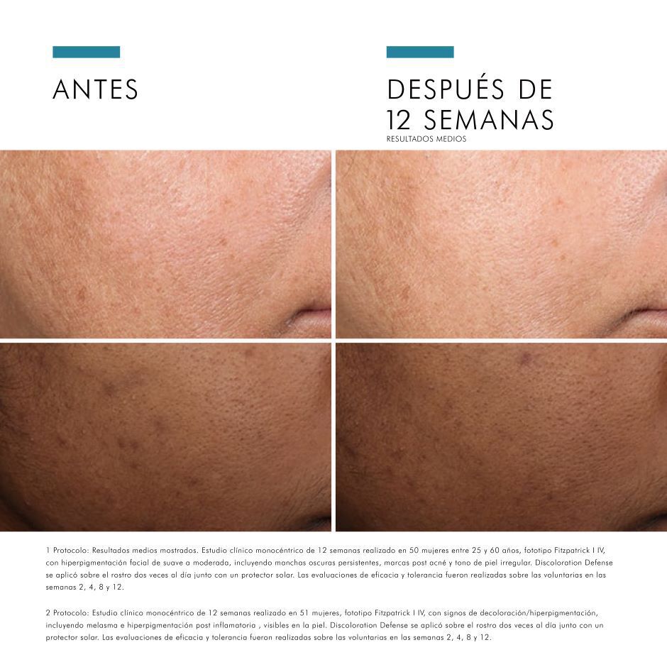 Antes vs Despues de Discoloration Defense | SkinCeuticals Mexico