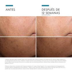 Antes vs Despues de Discoloration Defense | SkinCeuticals Mexico