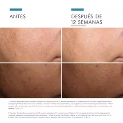 Antes vs Despues de Discoloration Defense | SkinCeuticals Mexico