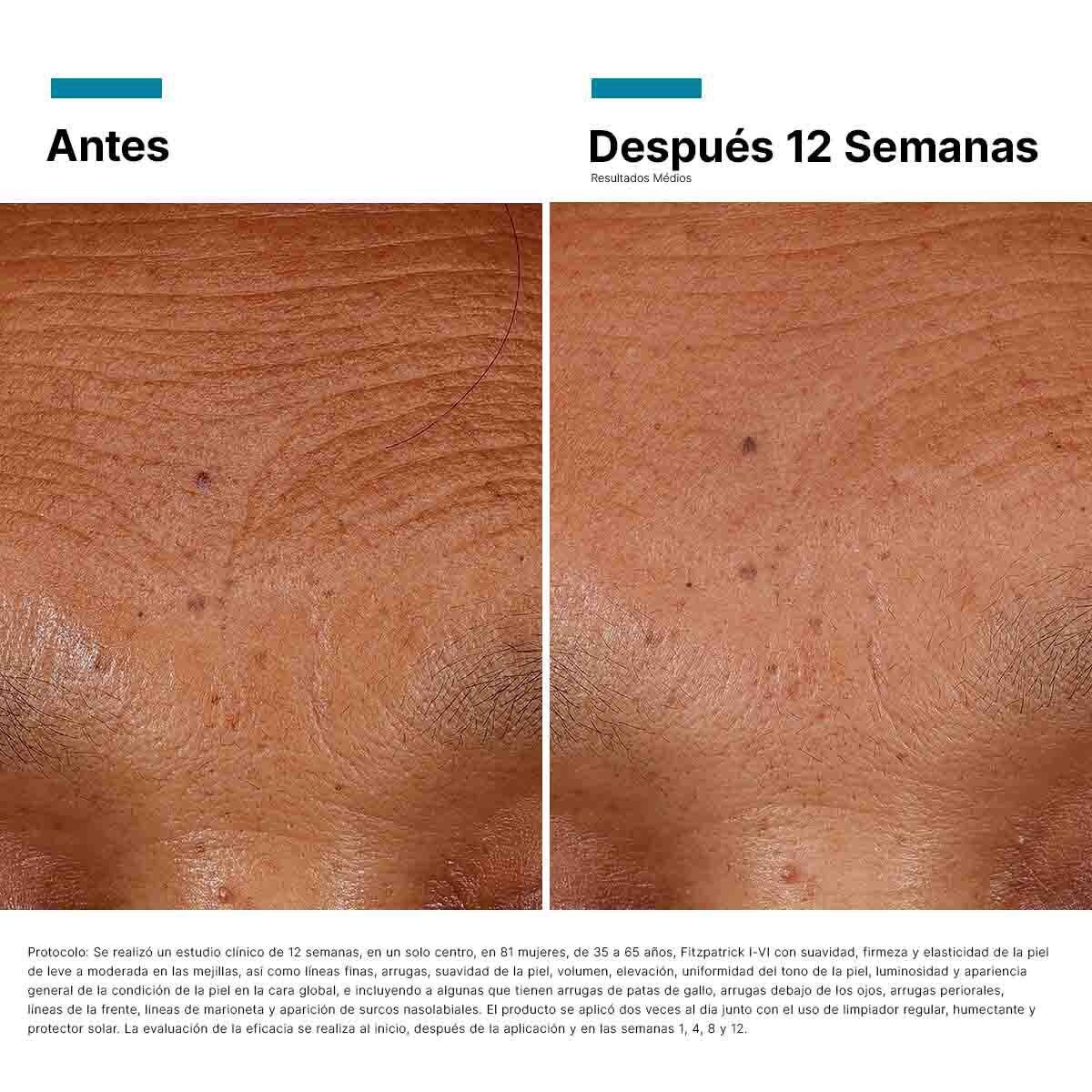 Antes vs Despues de HA Intensifier Multi-Glycan | SkinCeuticals Mexico
