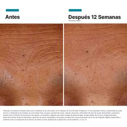 Antes vs Despues de HA Intensifier Multi-Glycan | SkinCeuticals Mexico