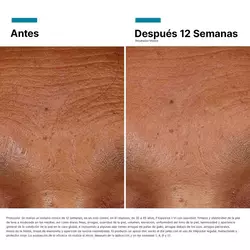 Antes vs Despues de HA Intensifier Multi-Glycan | SkinCeuticals Mexico