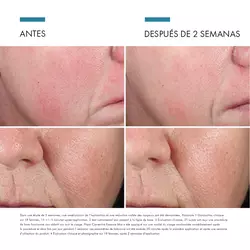 Antes vs Despues de Phyto Corrective Essence Mist | SkinCeutical Mexico
