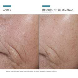 C E Ferulic - Antes vs Despues | SkinCeuticals Mexico