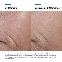 A.G.E. Interrupter Ultra Serum