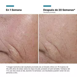 A.G.E. Interrupter Ultra Serum