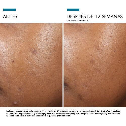 Antes vs Despues de Phyto A+ Brightening Treatment| SkinCeuticals Mexico