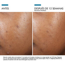 Antes vs Despues de Phyto A+ Brightening Treatment| SkinCeuticals Mexico