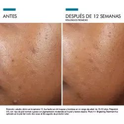 Antes vs Despues de Phyto A+ Brightening Treatment| SkinCeuticals Mexico